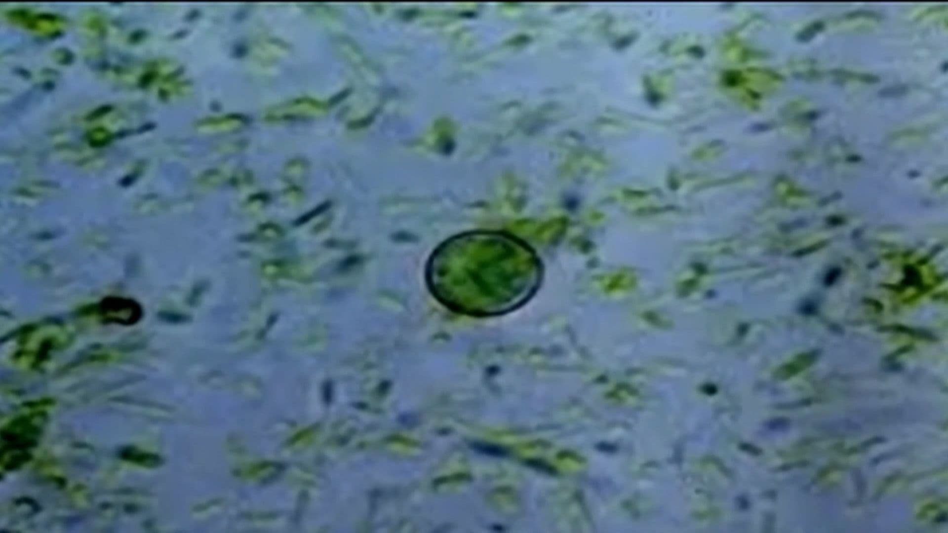 More than 60 North Carolina cases tied to parasite behind 'explosive diarrhea'