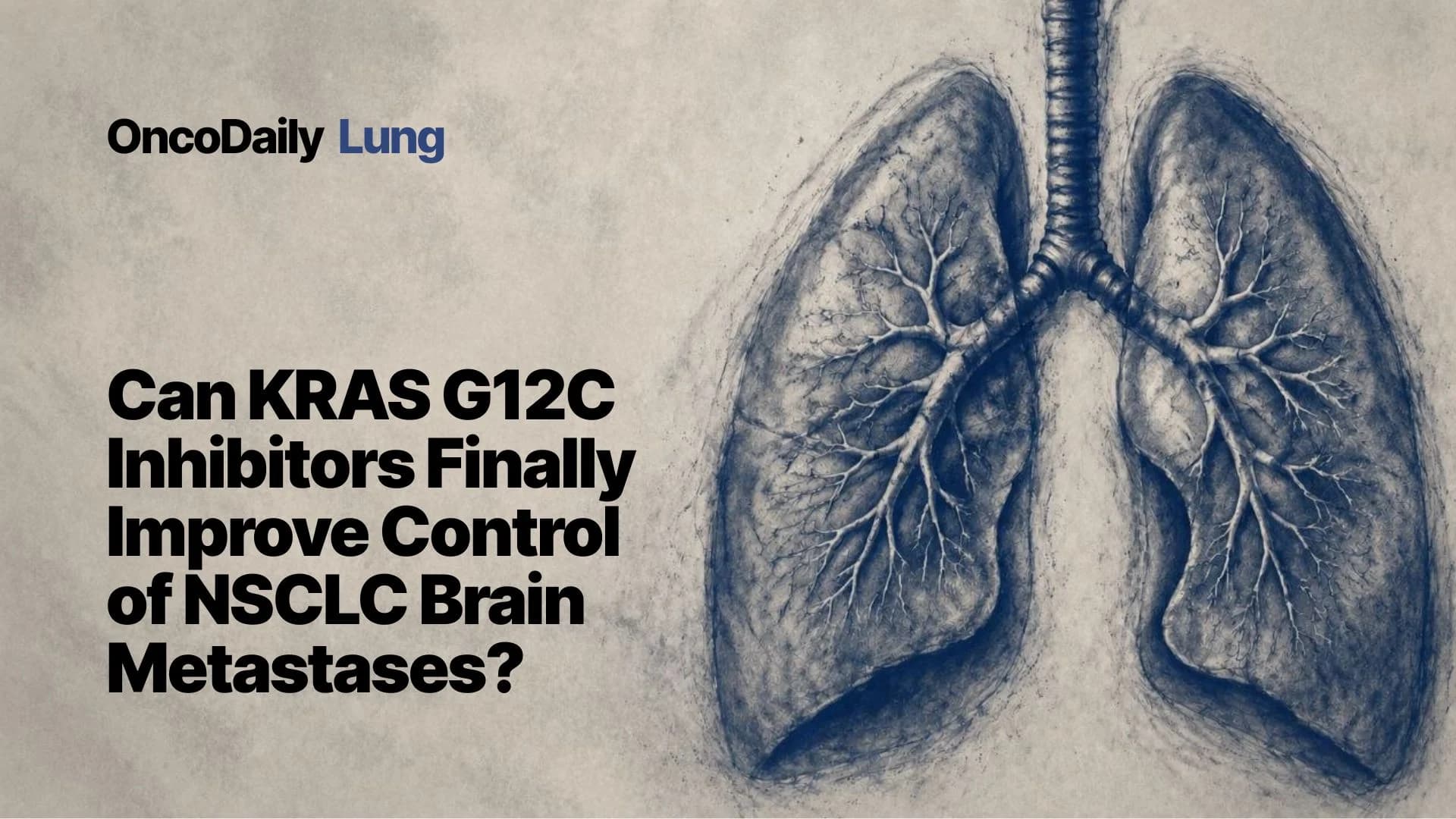 KRASG12C Inhibitors in NSCLC Brain Metastases: Why Intracranial Control Still Requires More Than Monotherapy