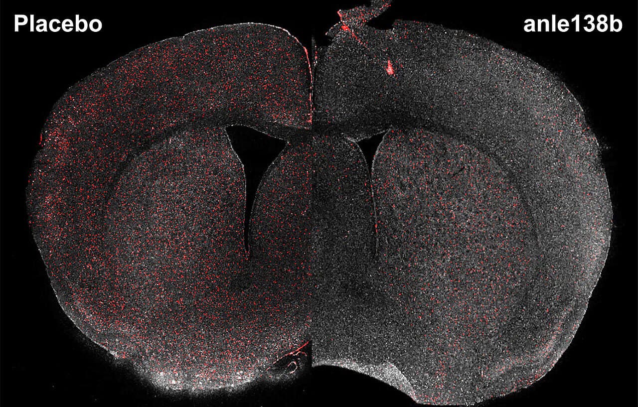 Experimental drug alleviates symptoms of Huntington's disease