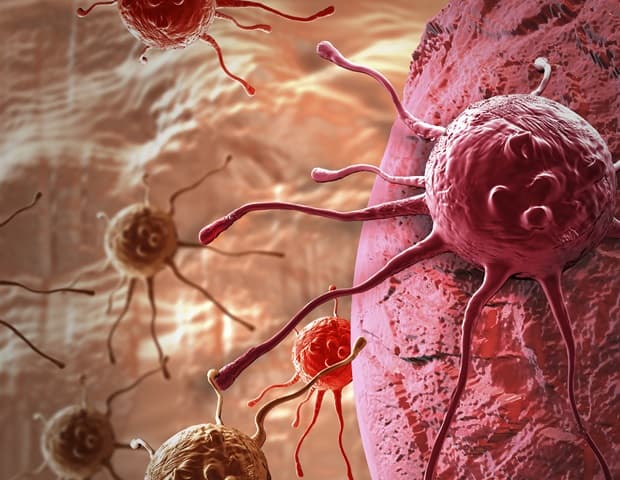 German study identifies therapeutic Achilles' heel for advanced colorectal cancer