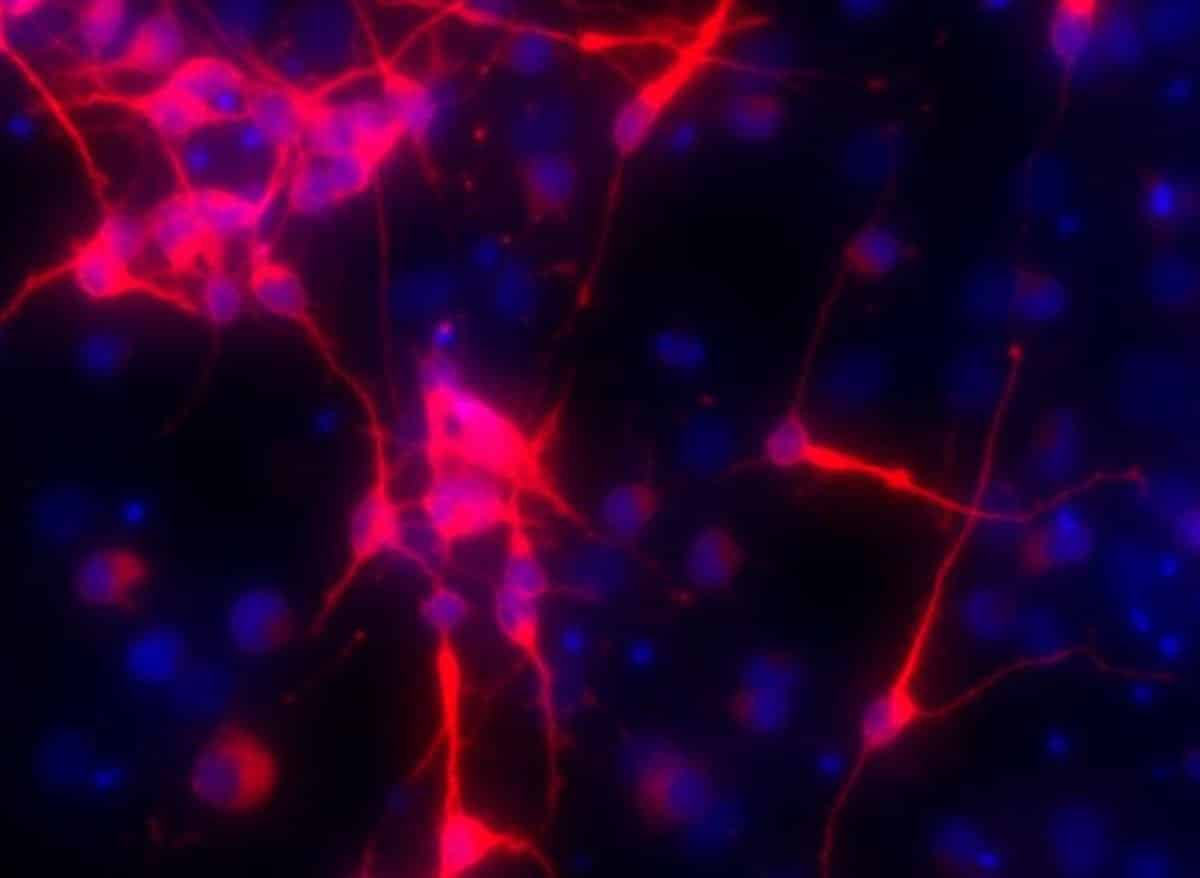 Fructose Diets Epigenetically Scar Fetal Brain Cells